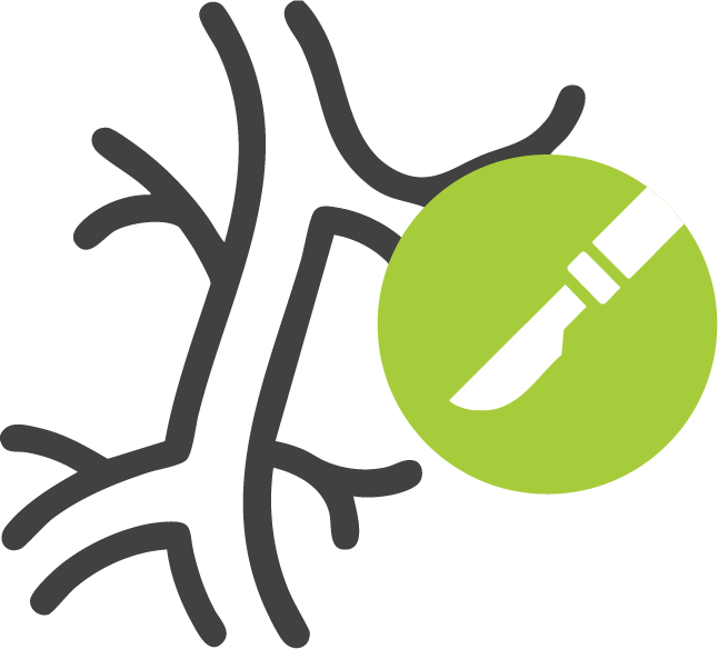 Cirugía Vascular y Angiológica